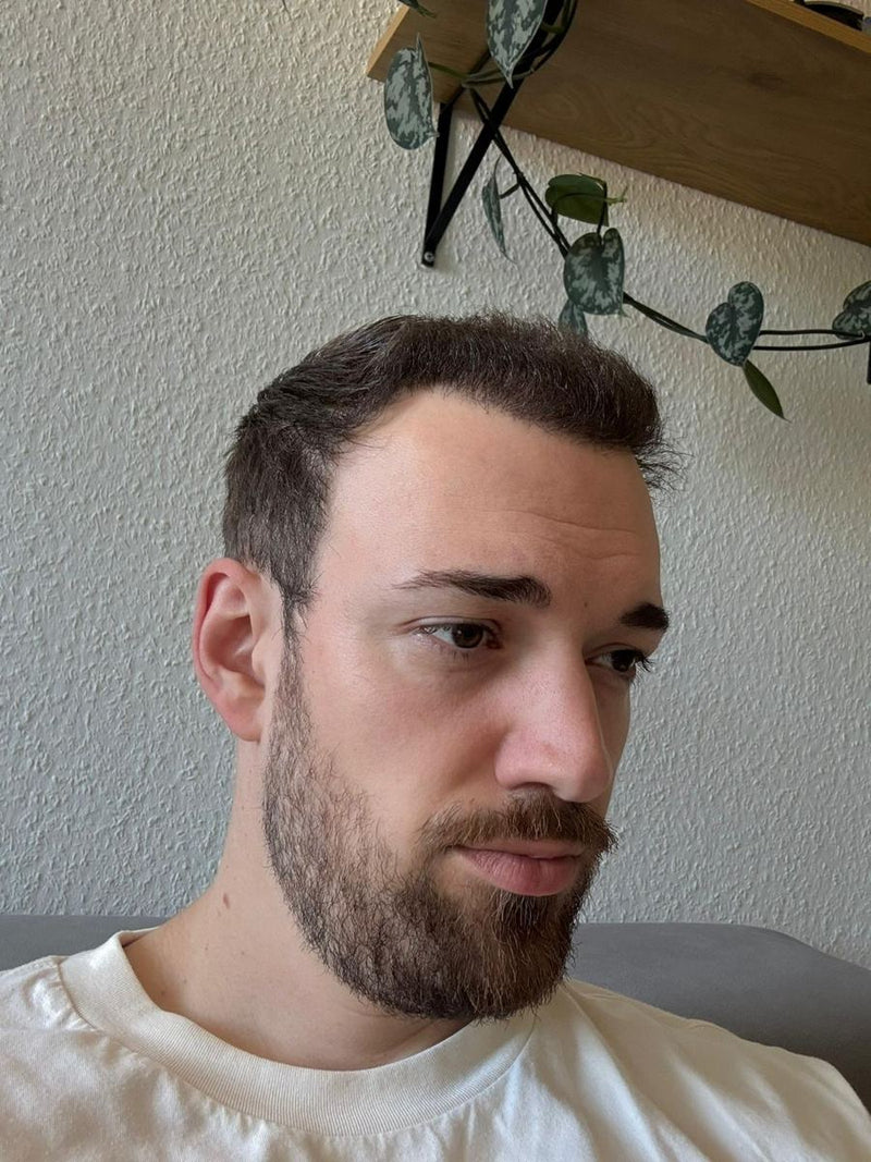 Das Wachstum beginnt.