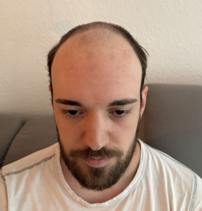 Der Ausgangspunkt.