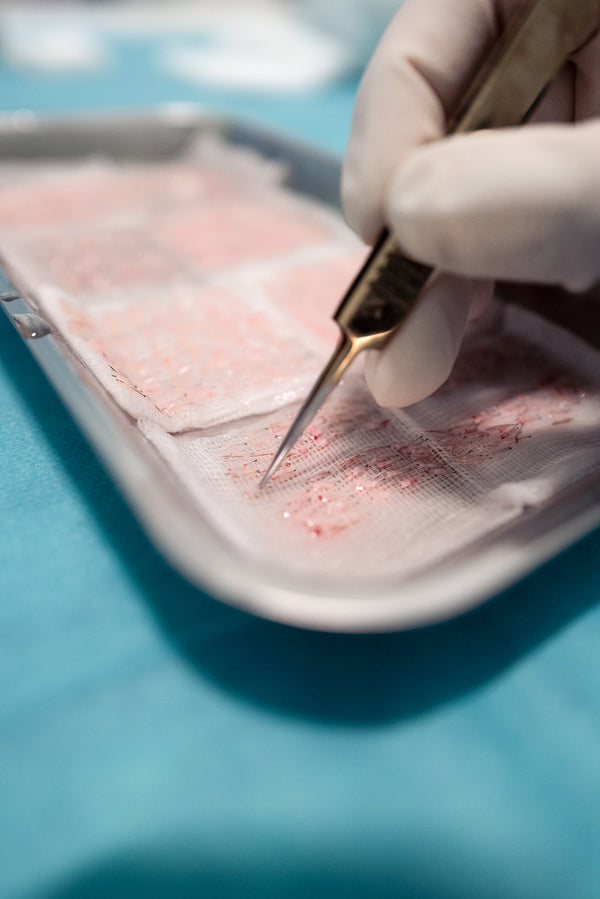 Wie werden Grafts sortiert — und warum ist das entscheidend?
