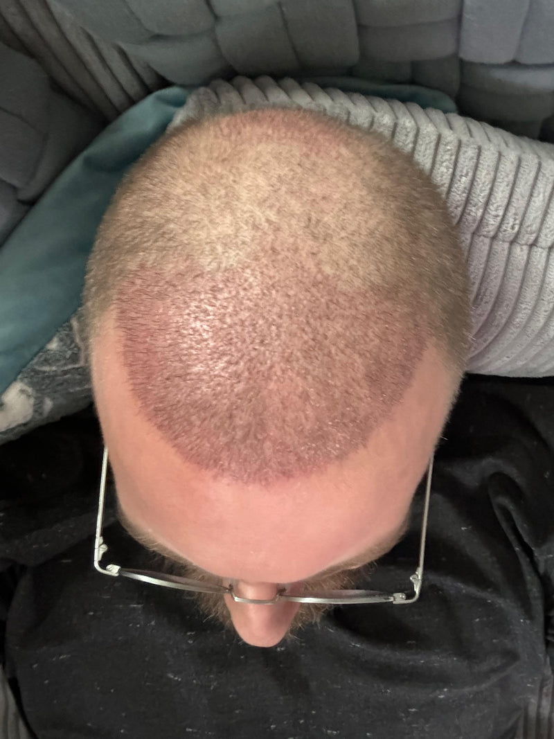 Heilungsphase — offen dokumentiert.